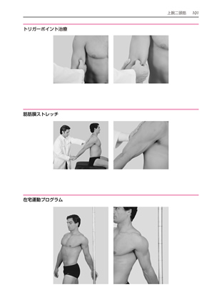 トリガーポイントと筋筋膜療法マニュアル ｜ 医道の日本社(公式 